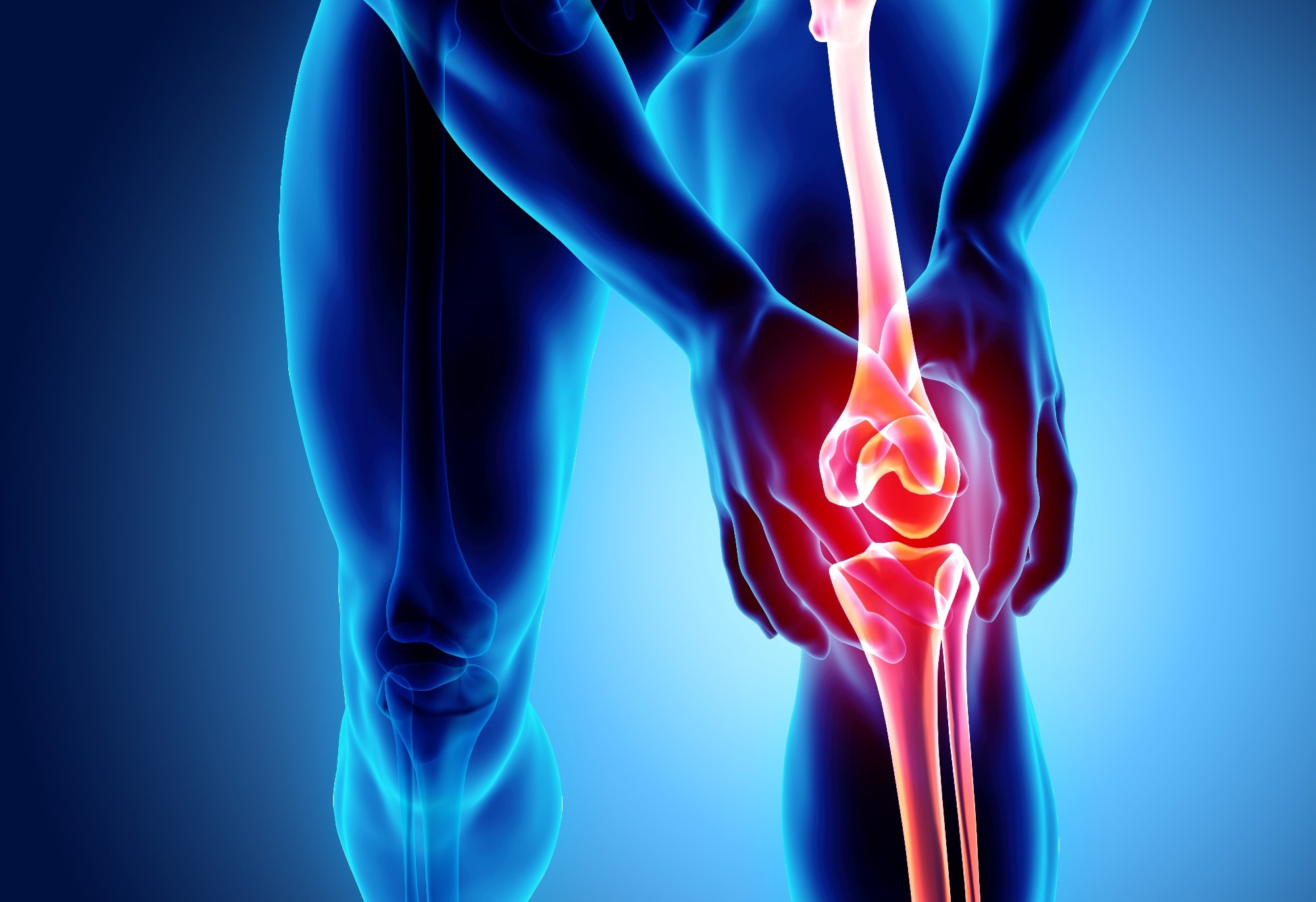 Study: An injectable copolymer of fatty acids (ARA 3000 BETA) as a promising treatment for osteoarthritis. Image Credit: MDGRPHCS/Shutterstock.com