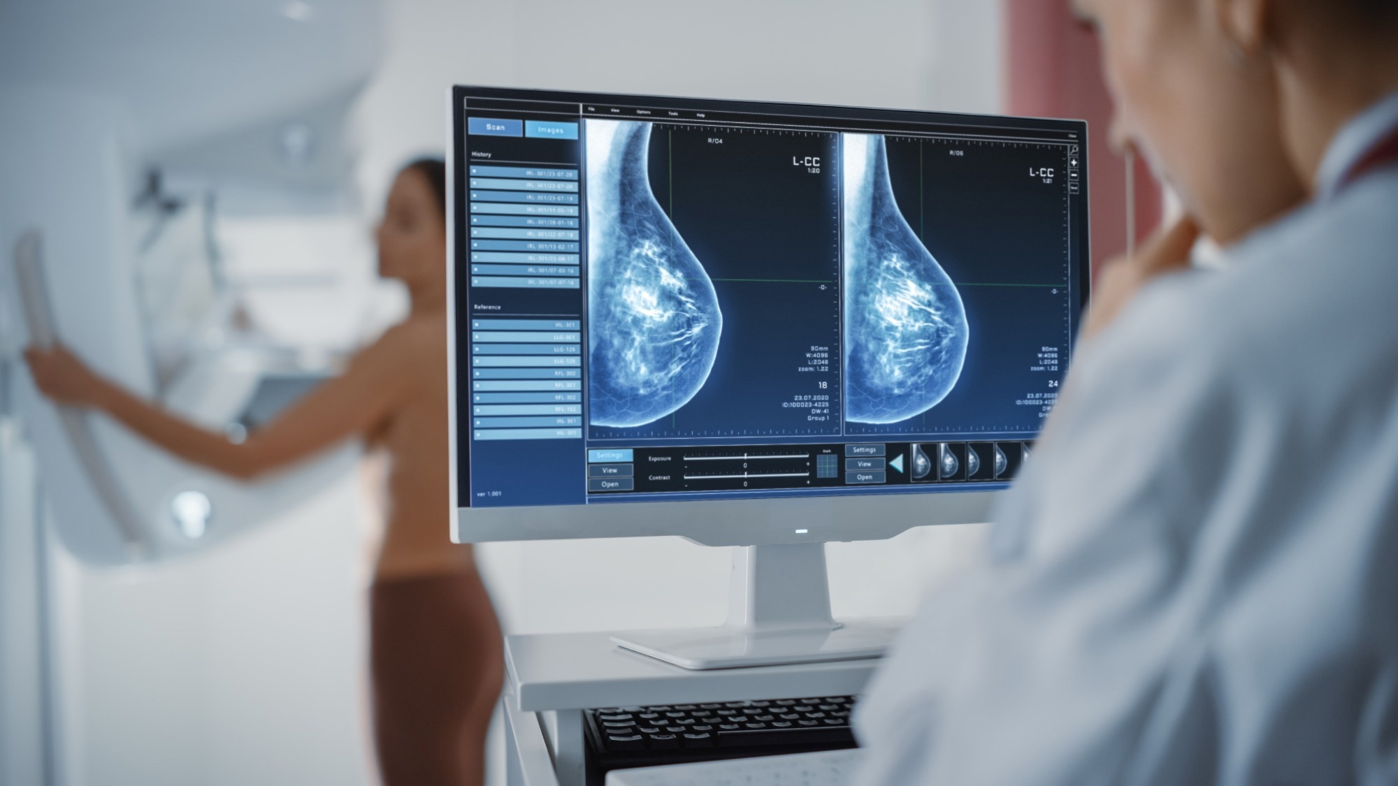 مطالعه: جابجایی های مرتبط با ERα زمینه ساز تقویت انکوژن در سرطان پستان است.  اعتبار تصویر: Gorodenkoff/Shutterstock.com