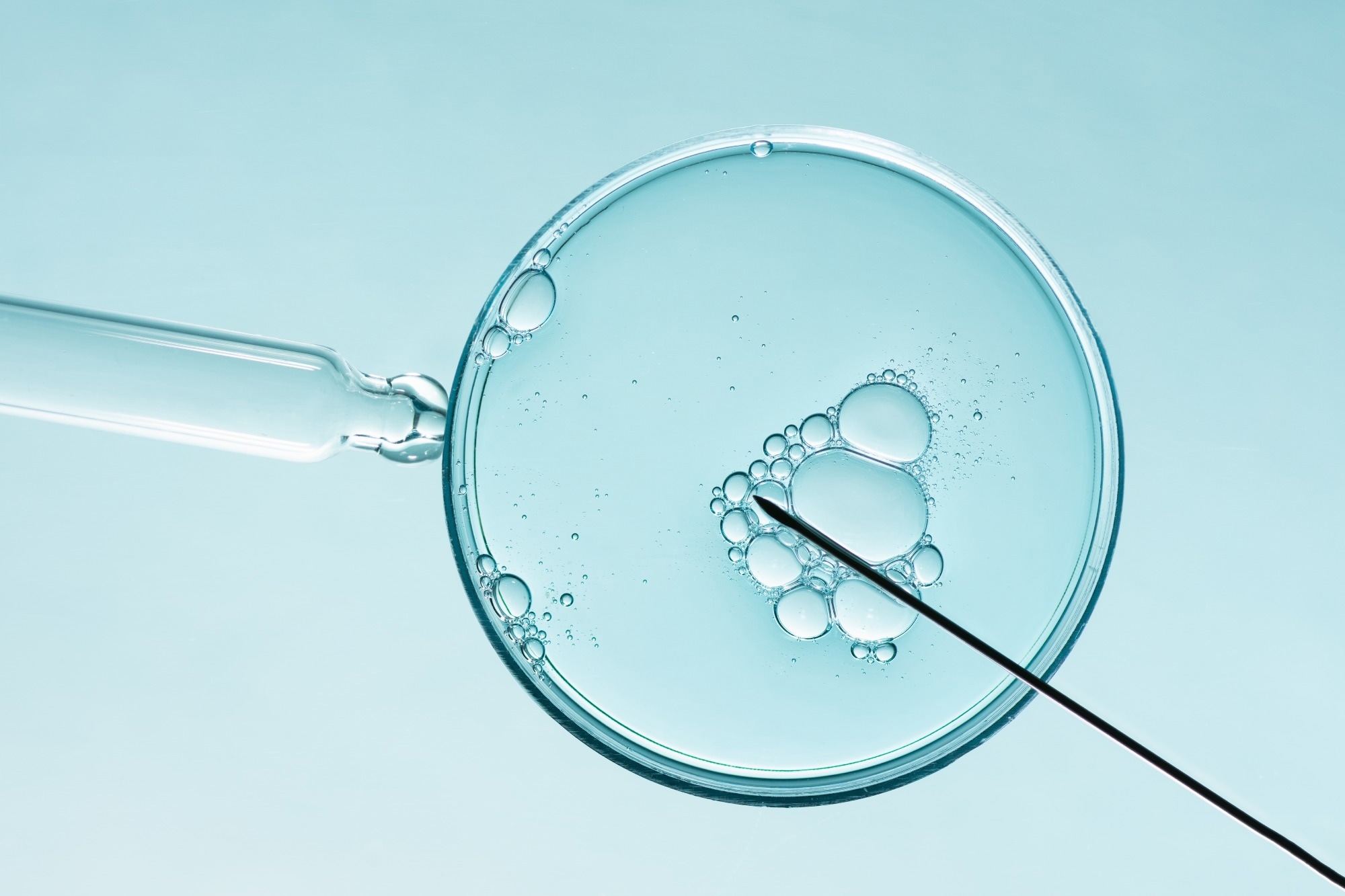Study: Artificial Intelligence (AI) for Sperm Selection – a Systematic Review. Image Credit: Inna Dodor / Shutterstock.com