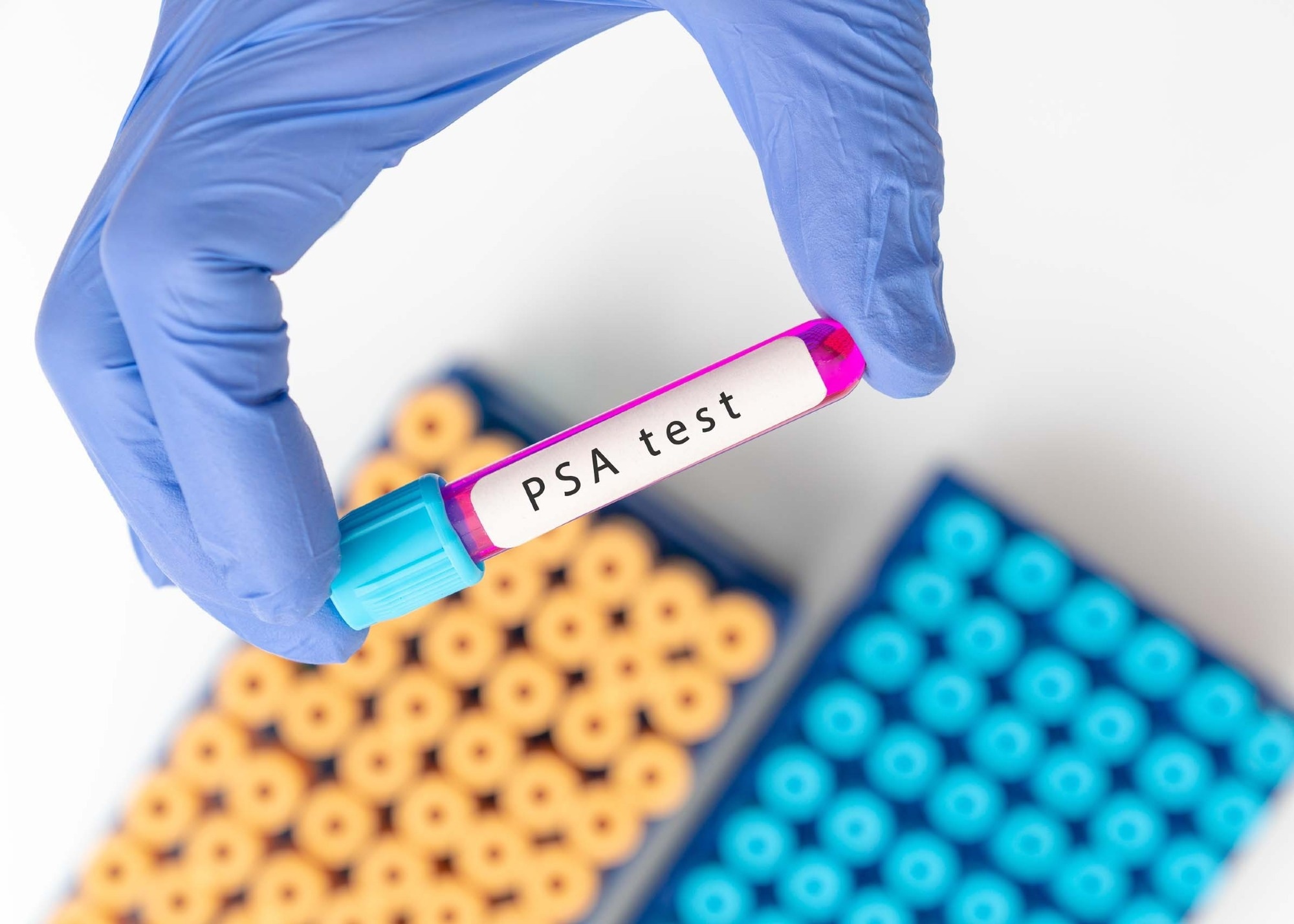 Study: Genetically adjusted PSA levels for prostate cancer screening. Image Credit: luchschenF/Shutterstock.com