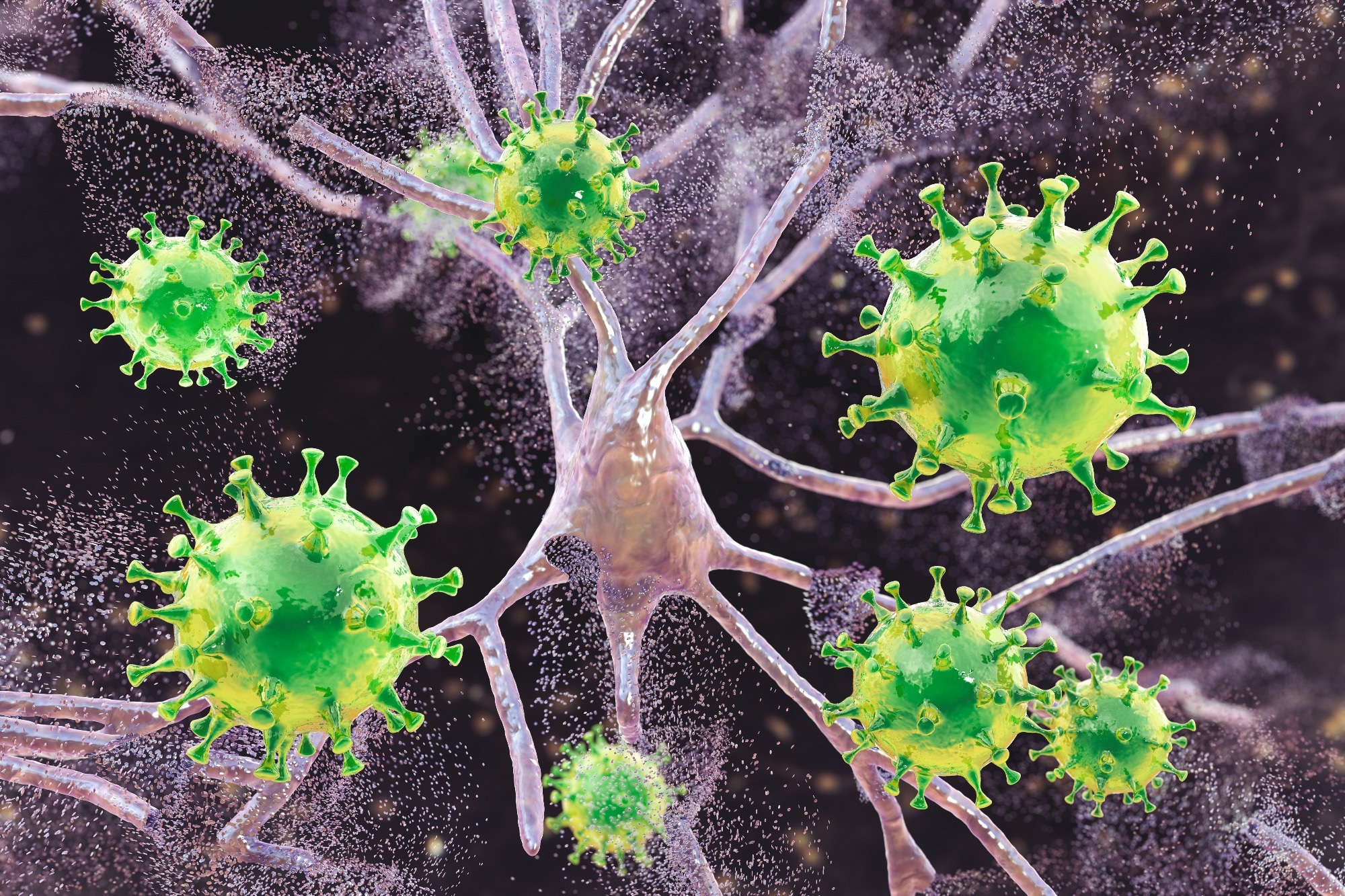 Study: Notes from the field: pediatric intracranial infections — Clark County, Nevada, January–December 2022. Image Credit: Kateryna Kon / Shutterstock.com