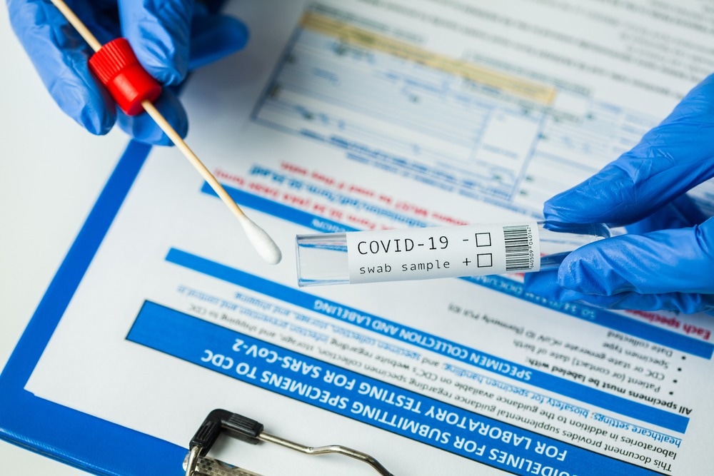 Study: Discontinuation of Universal Admission Testing for SARS-CoV-2 and Hospital-Onset COVID-19 Infections in England and Scotland. Image Credit: Cryptographer/Shutterstock.com