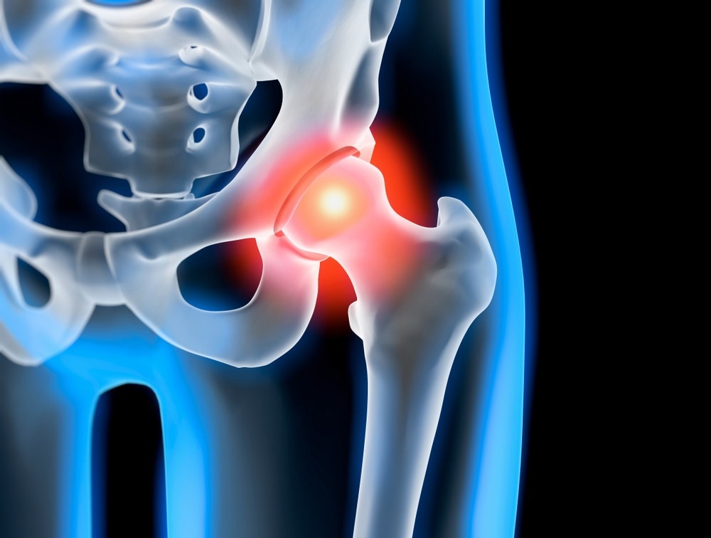 Study: Post-COVID condition in patients with inflammatory rheumatic diseases: a prospective cohort study in the Netherlands. Image Credit: peterschreiber.media/Shutterstock.com
