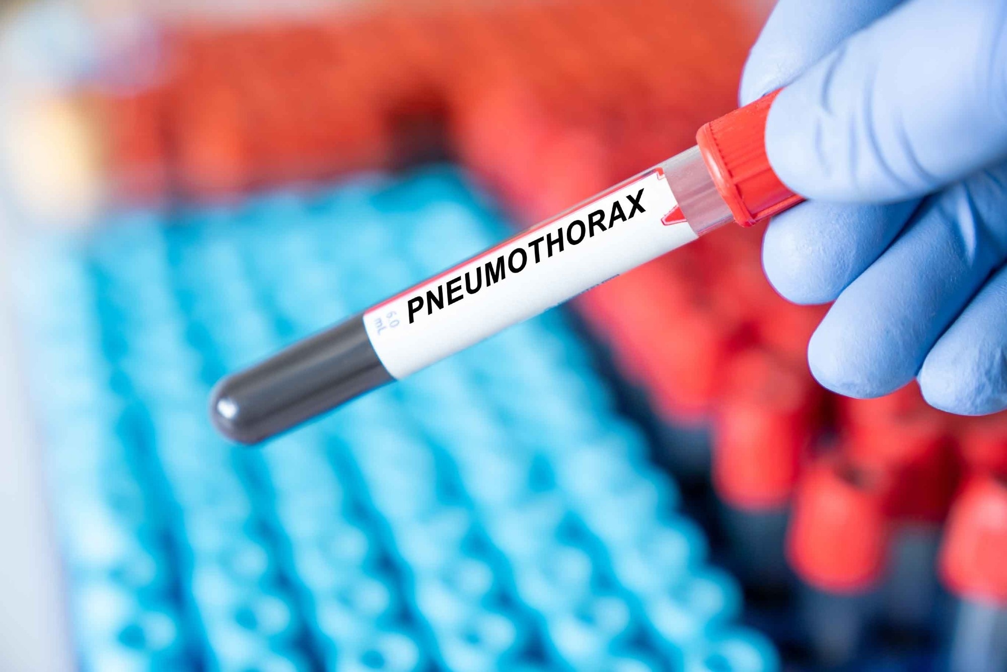 Pneumothorax prevalence in COVID-19 and influenza patients