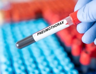 Pneumothorax prevalence in COVID-19 and influenza patients