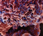 SARS-CoV-2 hijacks body's metabolism to amplify COVID-19 severity
