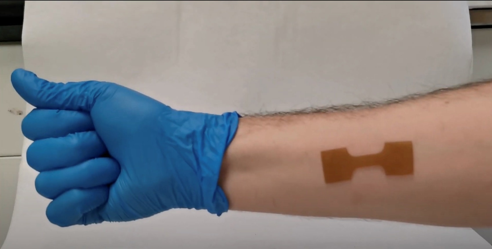 Intelligent wound dressing material could bring pain relief to burn patients