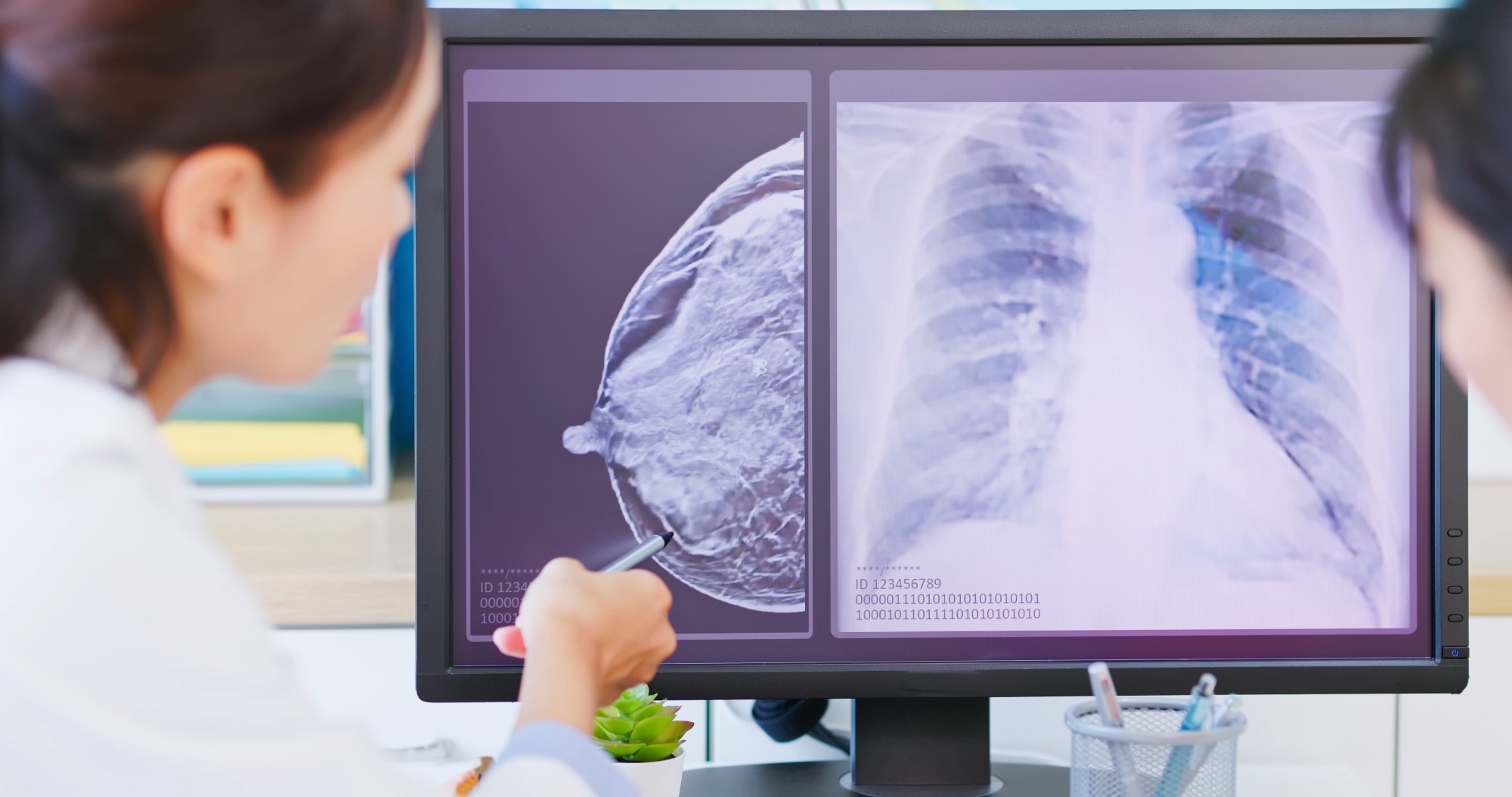 Study: Combining machine learning with Cox models to identify predictors for incident post-menopausal breast cancer in the UK Biobank. Image Credit: aslysun / Shutterstock.com