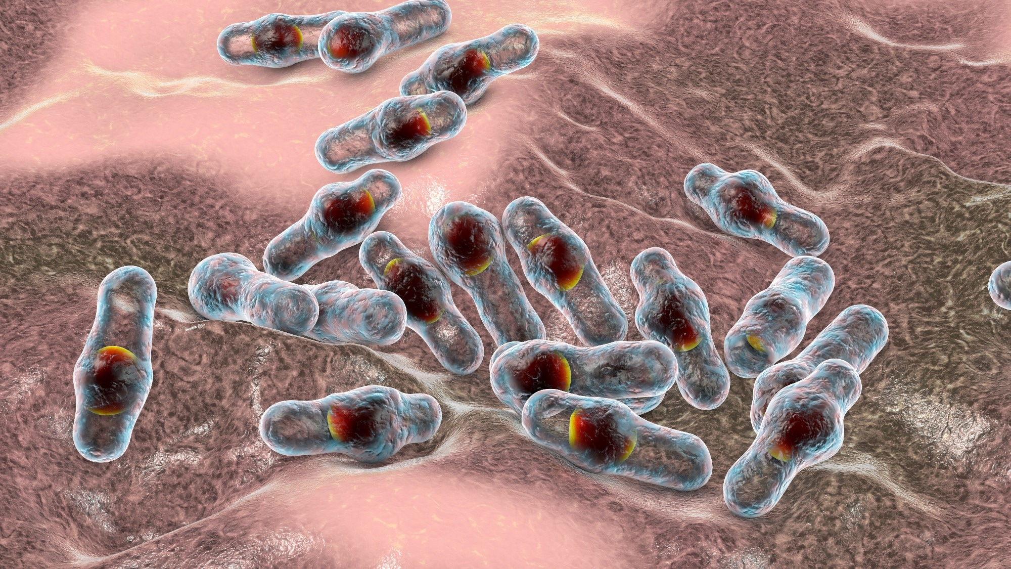 Study: A large travel-associated outbreak of iatrogenic botulism in four European countries following intragastric botulinum neurotoxin injections for weight reduction, Türkiye, February to March 2023. Image Credit: Kateryna Kon / Shutterstock.com