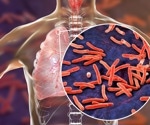 Latent tuberculosis infection results for the United States from the 2019–2020 National Health and Nutrition Examination Survey