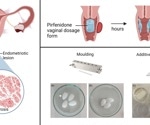 3D-printed vaginal ovules offer promising treatment for endometriosis