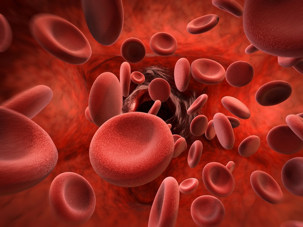 Étude : Le groupe sanguin A améliore l'infection par le SRAS-CoV-2.  Crédit image : Phonlamai Photo/Shutterstock.com