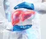 CRISPR/Cas9-based screening identifies potential therapies for non-alcoholic fatty liver disease