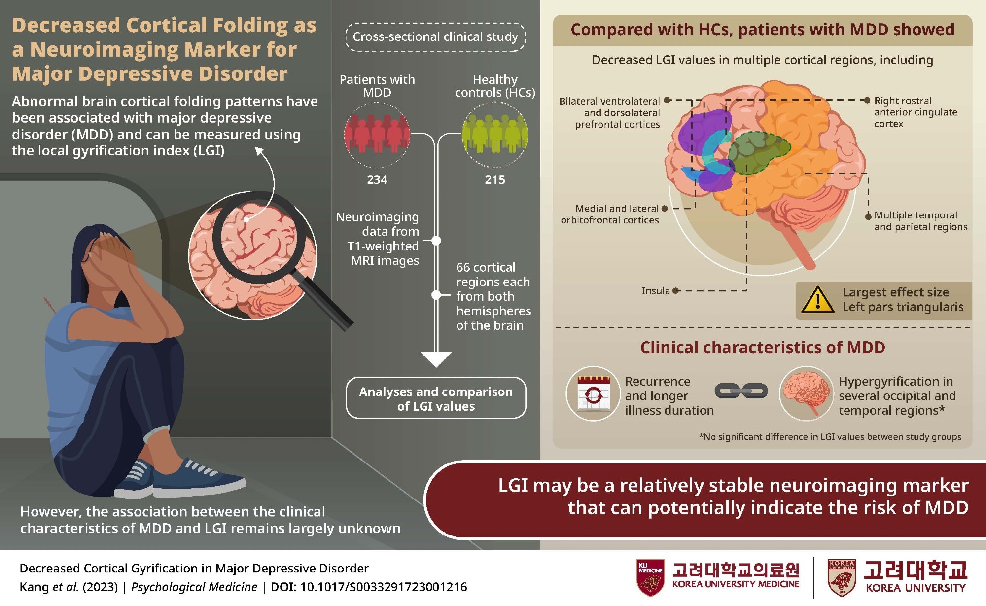 Abnormal cortical folding linked to major depressive disorder