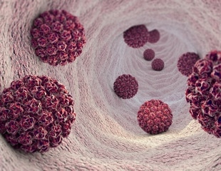 Understanding the impact of HPV on the vaginal microbiome and its role in cervical cancer