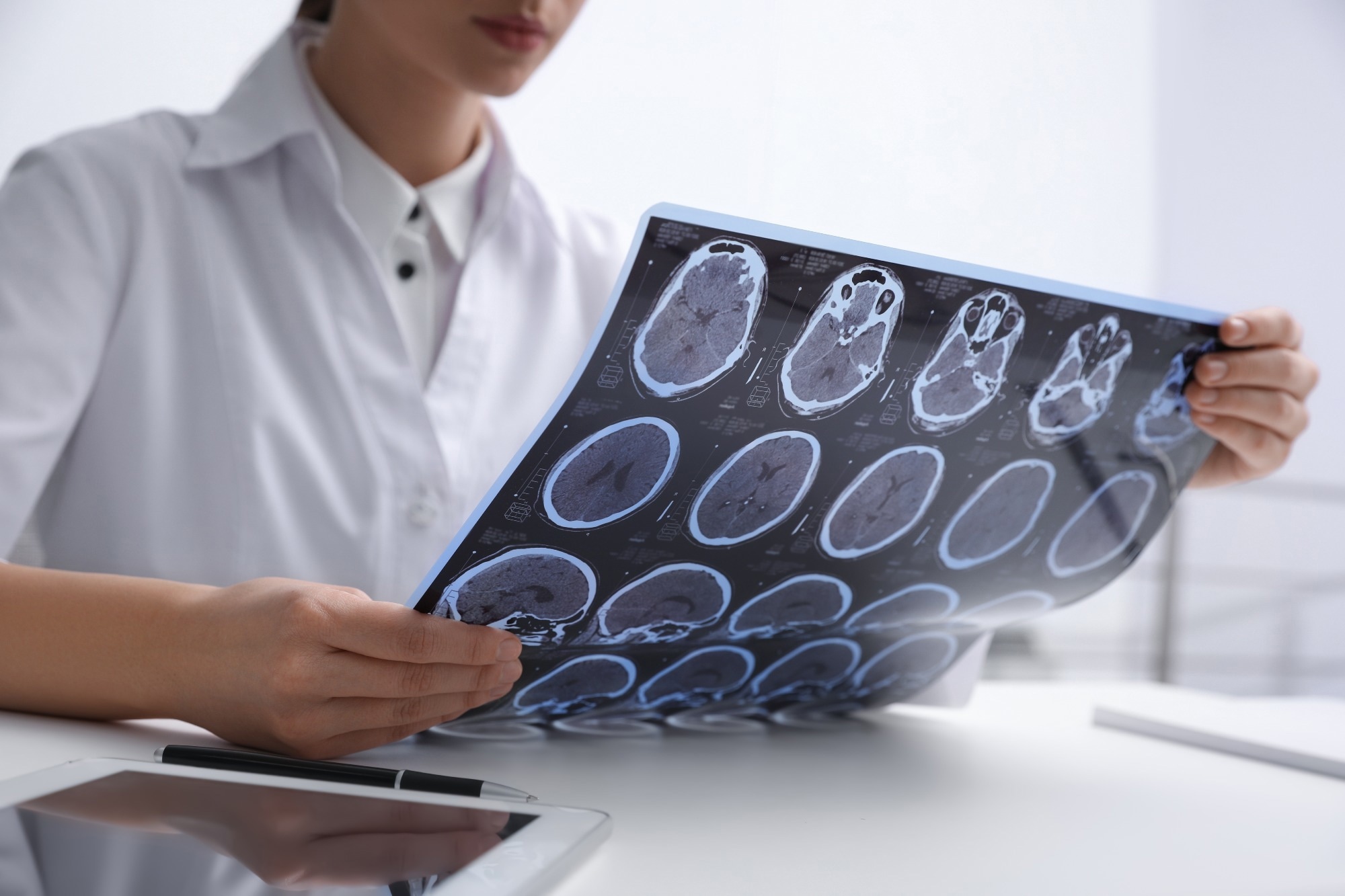 Study: Common infections and neuroimaging markers of dementia in three UK cohort studies. Image Credit: NewAfrica/Shutterstock.com