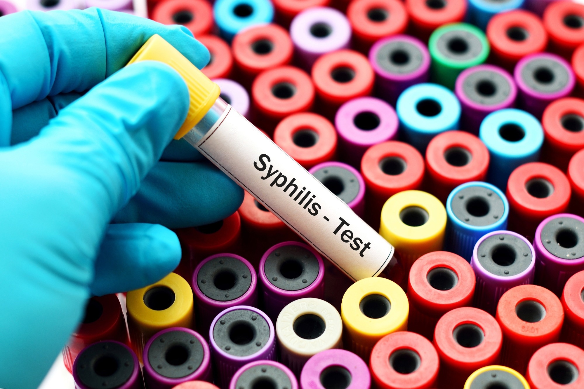 Study: The role of syphilis self-testing as an additional syphilis testing approach in key populations: a systematic review and meta-analysis. Image Credit: JarunOntakrai/Shutterstock.com