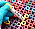 Study highlights advantages of syphilis self-testing: convenience, privacy, and rapid results