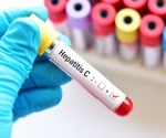 CDC report highlights the gaps in care of hepatitis C treatment