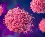 Epigenetic manipulation may improve breast cancer treatment responses