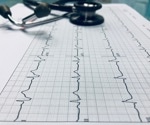 New AI-based screening strategy uses ECG to detect heart defects