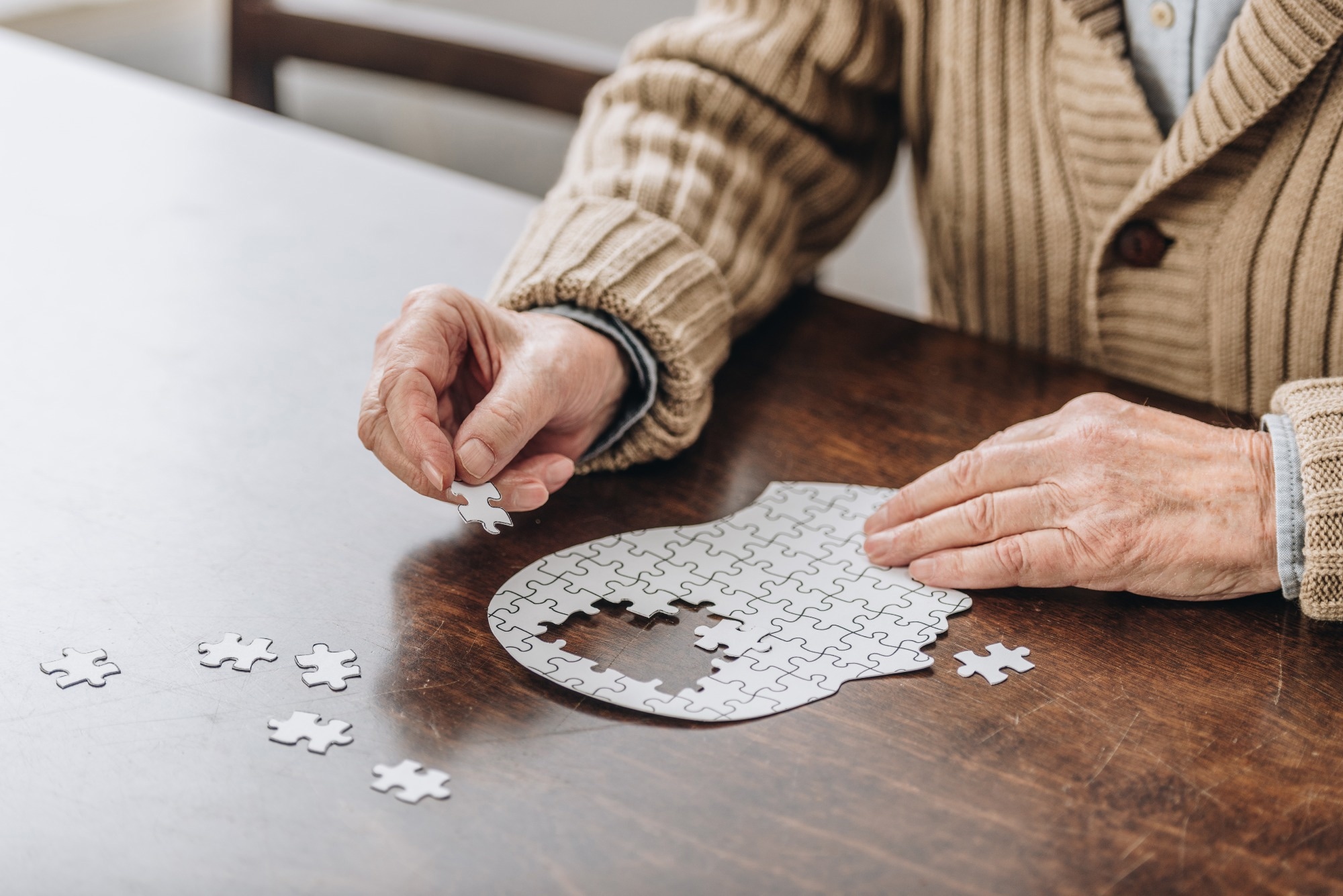 Study: Neuroimaging and machine learning for studying the pathways from mild cognitive impairment to alzheimer’s disease: a systematic review. Image Credit: LightField Studios/Shutterstock.com