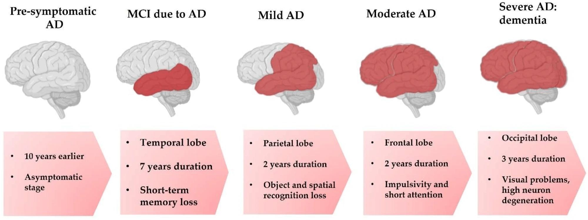 Progressive stages in the development of AD