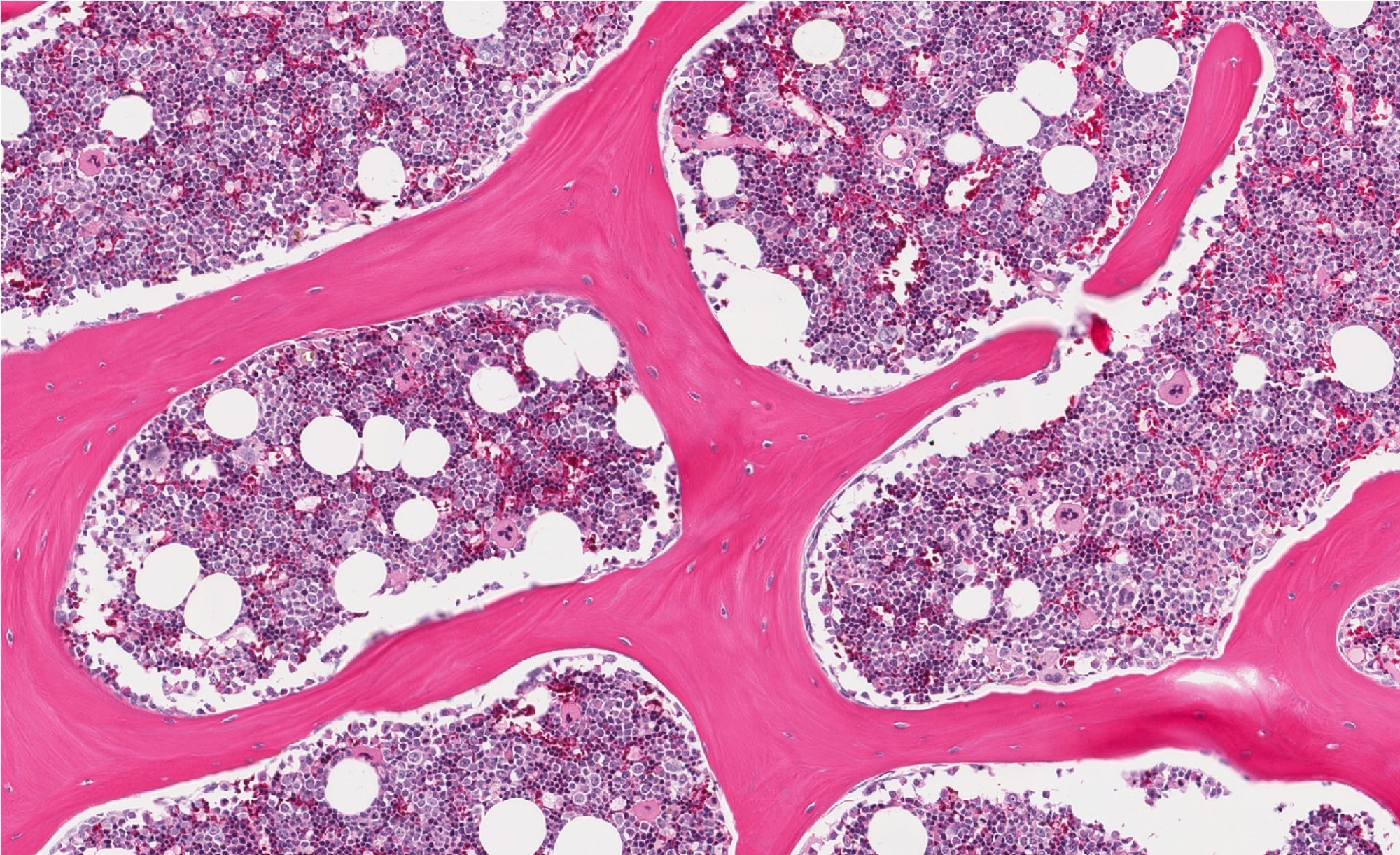 Study: Hematopoietic-specific heterozygous loss of Dnmt3a exacerbates colitis-associated colon cancer. Image Credit: vetpathologist/Shutterstock.com