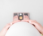 Obesity in early pregnancy increases long-term risk of venous thromboembolism