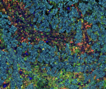 Flexible Spatial Biology Solution for Up to 8-Plex Amplification in Two Days: CST Launches SignalStar™ Multiplex IHC