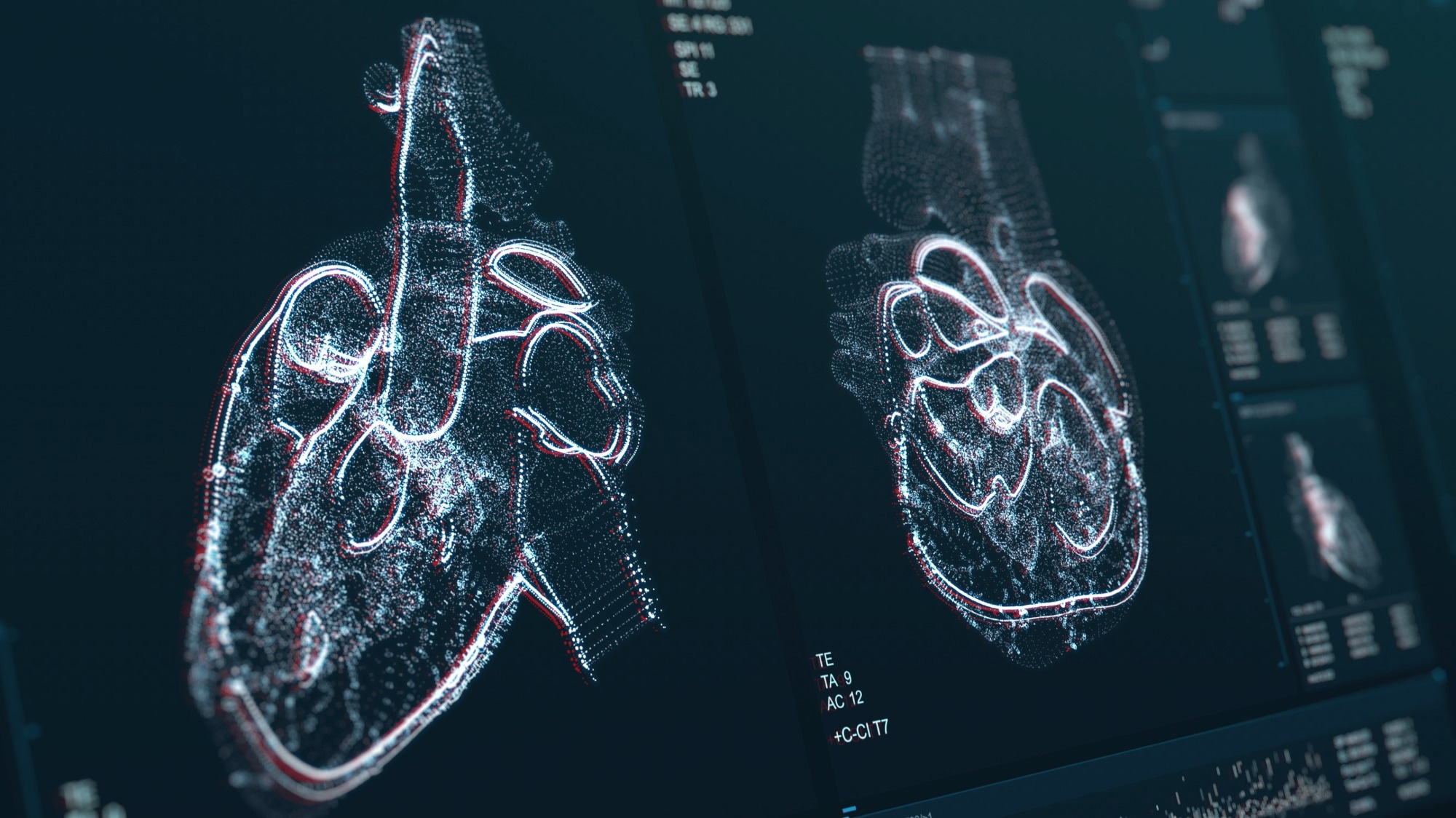 Study: Automated Large Vessel Occlusion Detection Software and Thrombectomy Treatment Times: A Cluster Randomized Clinical Trial. Image Credit: SquareMotion / Shutterstock.com