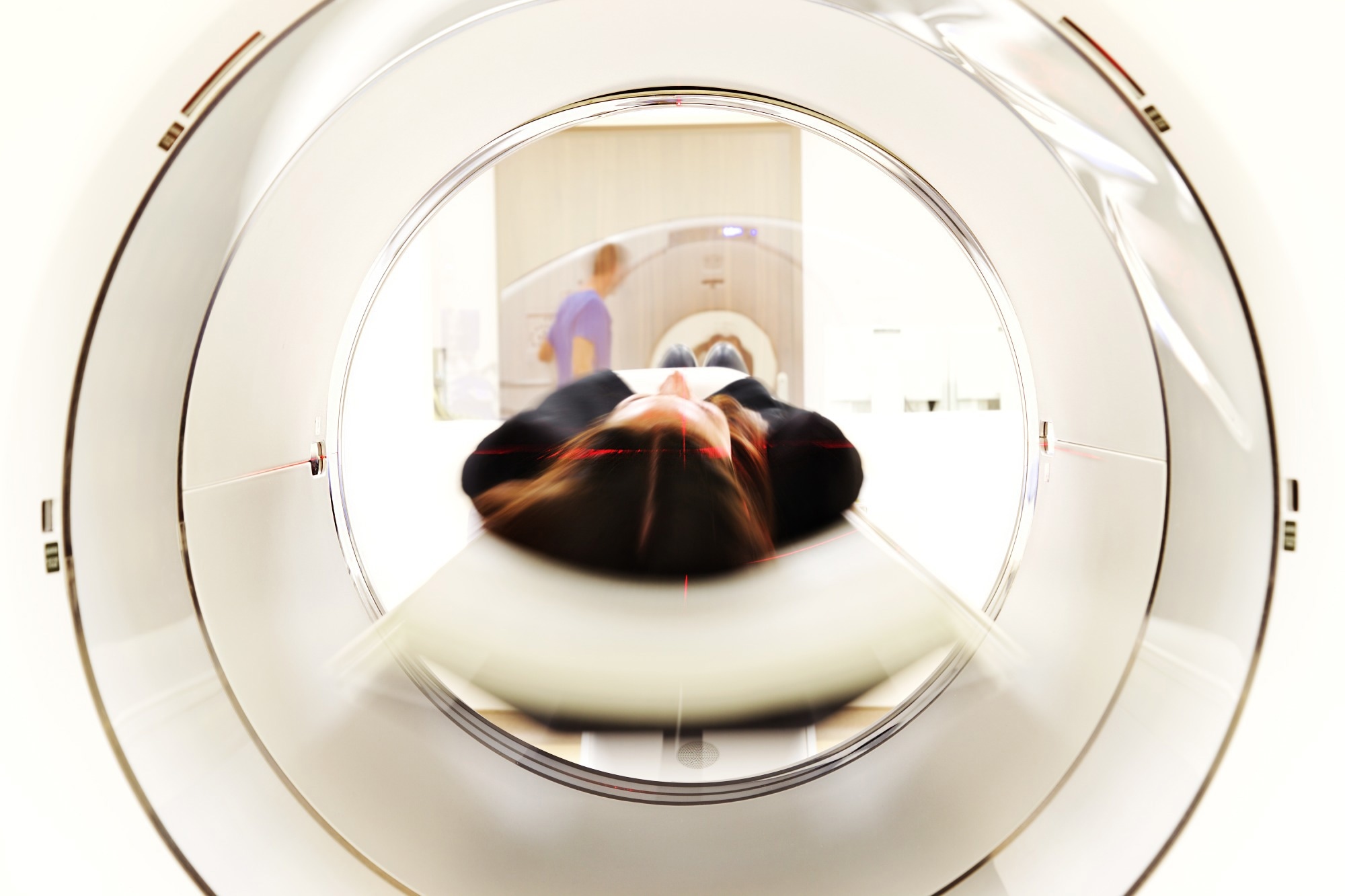 Deep learning revolutionizes ultra-low-field brain MRI for quicker 