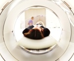 Deep learning revolutionizes ultra-low-field brain MRI for quicker, clearer scans