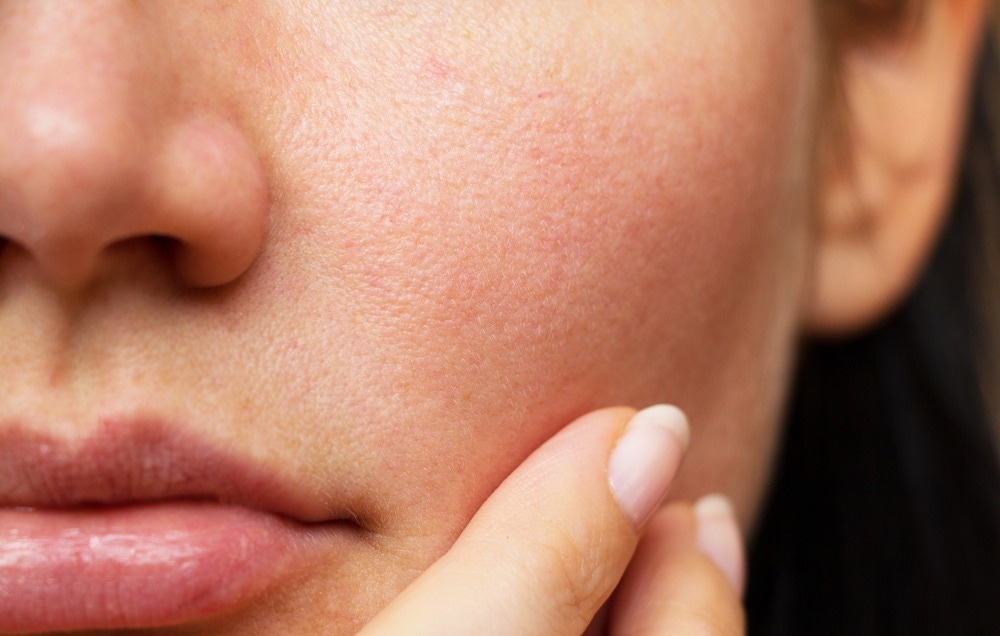 Study: Tension as a key factor in skin responses to pollution. Image Credit: Geinz Angelina/Shutterstock.com