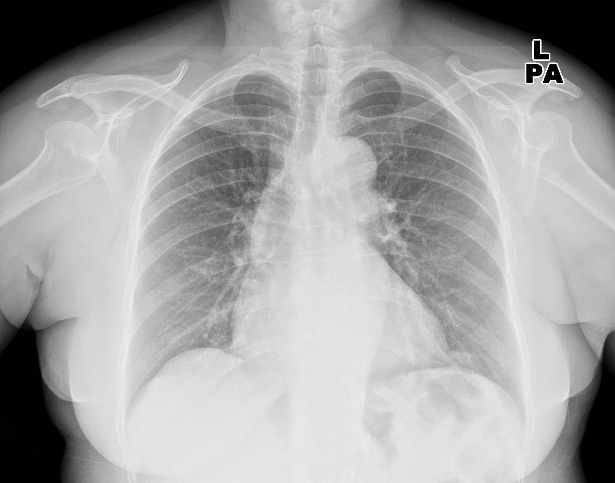 Study: Commercially Available Chest Radiograph AI Tools for Detecting Airspace Disease, Pneumothorax, and Pleural Effusion. Image Credit: KELECHI5050 / Shutterstock