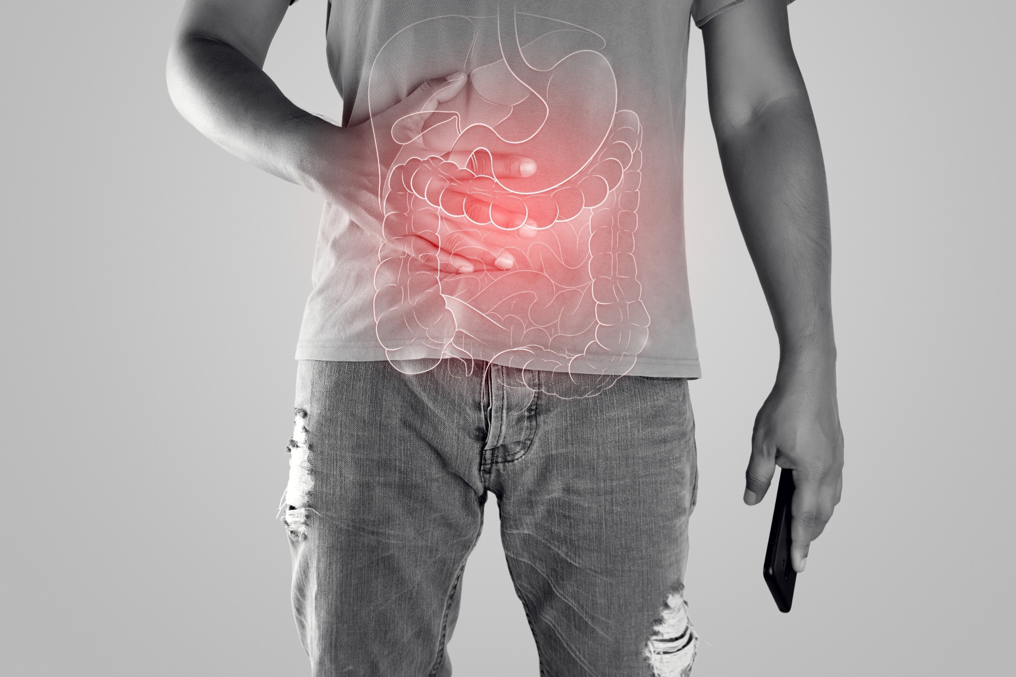 Is long COVID triggering irritable bowel syndrome? Arizona study to investigate