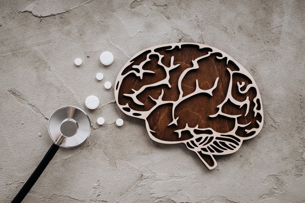 Study: Human microglial state dynamics in Alzheimer’s disease progression. Image Credit: Nefedova Tanya/Shutterstock.com