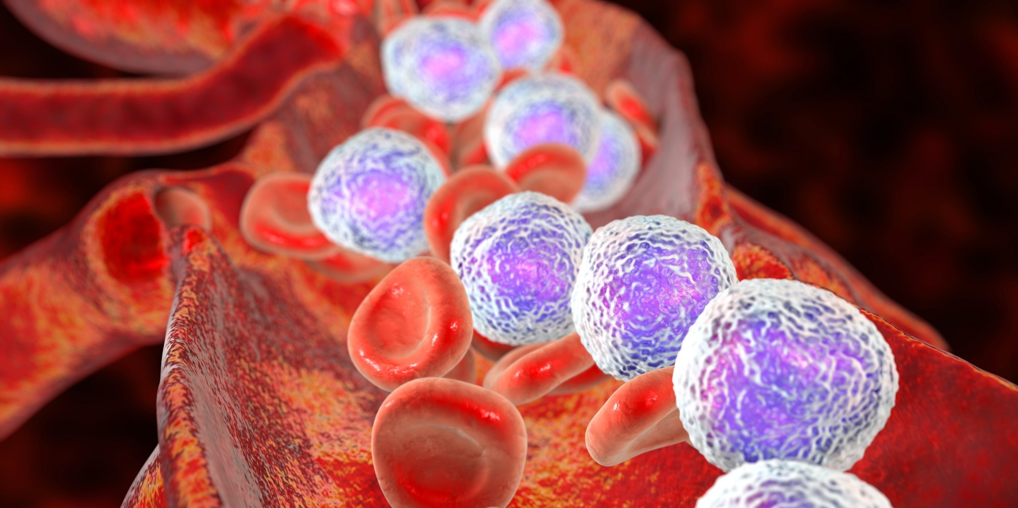 Study: Microbiota, Diet and Acute Leukemia: Tips and Tricks on their Possible Connections. Image Credit: Kateryna Kon / Shutterstock.com