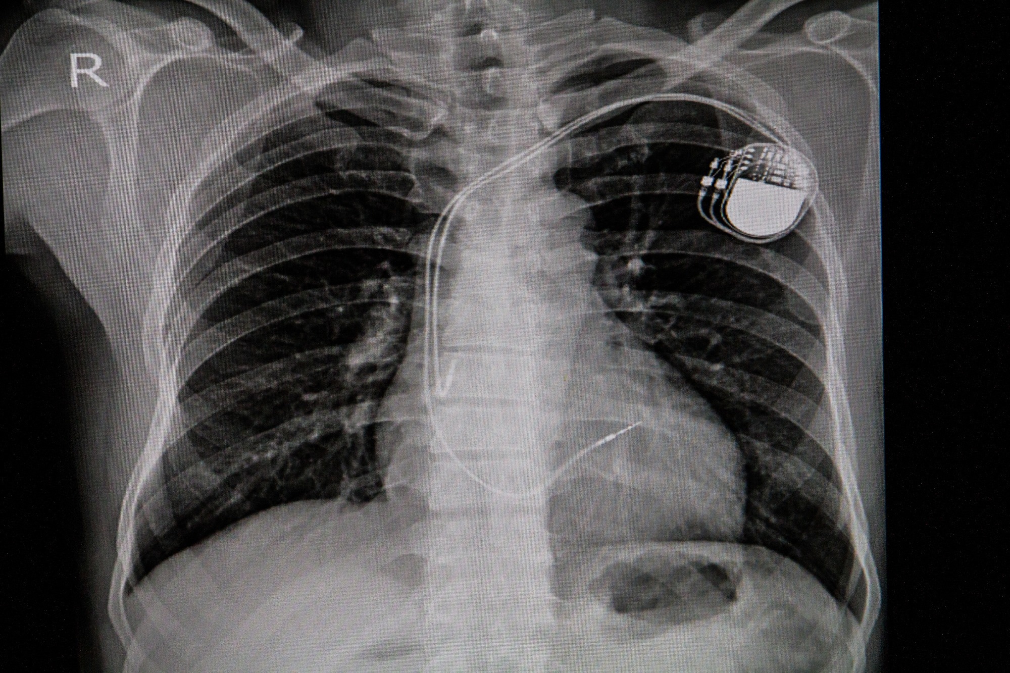 Study: Generative Artificial Intelligence for Chest Radiograph Interpretation in the Emergency Department. Image Credit: April stock / Shutterstock