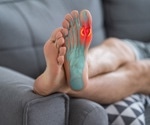 Gut's role in gout: New study unravels microbiome's influence on uric acid levels