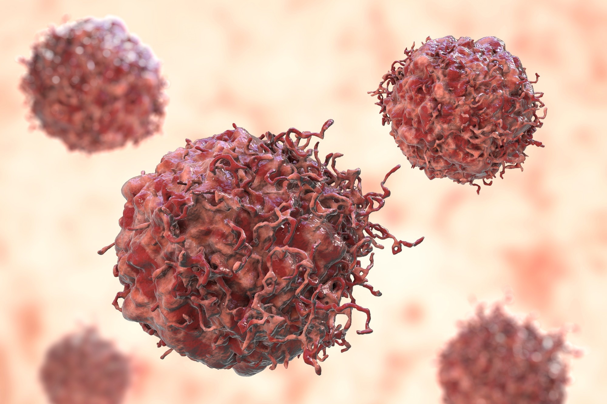 Study: TCF-1 limits intraepithelial lymphocyte antitumor Q1 immunity in colorectal carcinoma. Image Credit: Kateryna Kon / Shutterstock.com