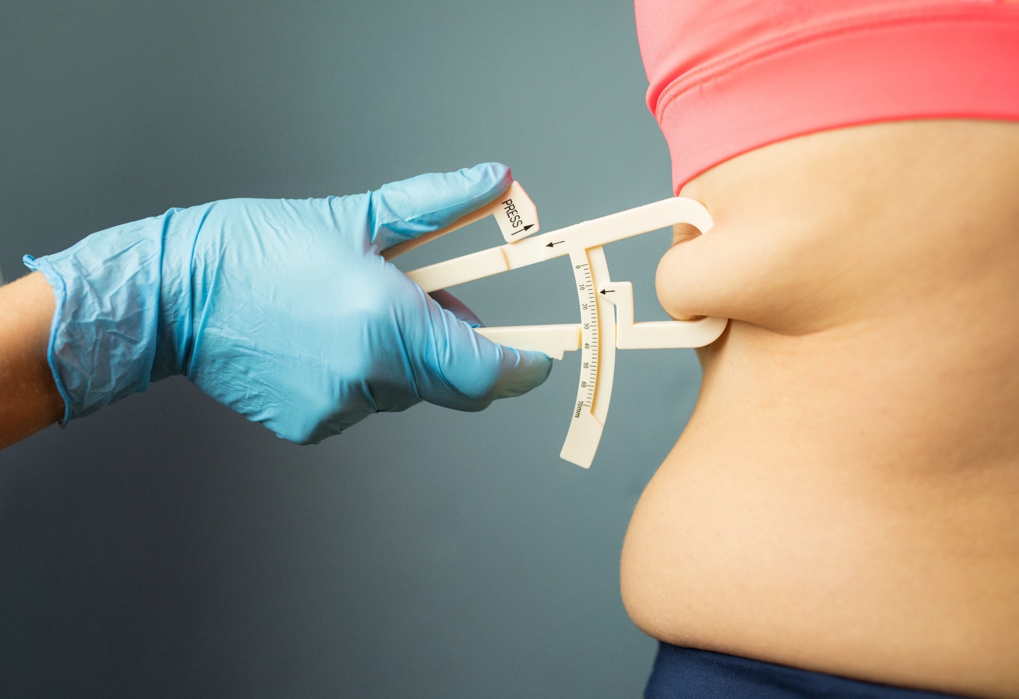 Study: Body Mass Index, Adverse Pregnancy Outcomes, and Cardiovascular Disease Risk. Image Credit: Kaspars Grinvalds / Shutterstock