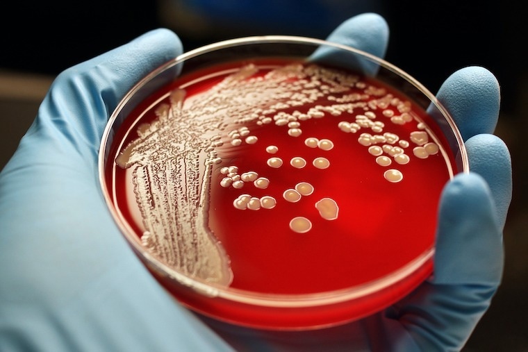 UVA scientists’ efforts could help better combat antibiotic-resistant bacteria