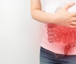 Does inflammatory bowel disease have a causal relationship with extracolonic tumors?