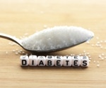 CT-measured VAT volume key in assessing diabetes risk in prediabetic individuals