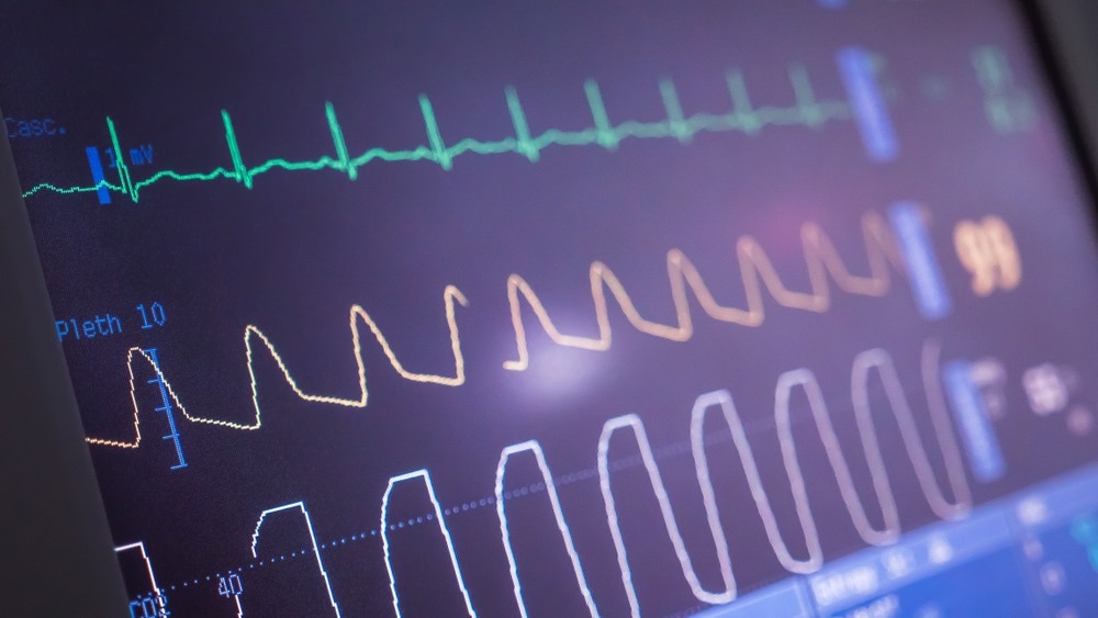 Study: Identification and risk stratification of coronary disease by artificial intelligence-enabled ECG. Image Credit: medijucentras/Shutterstock.com