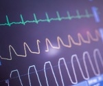 AI-powered ECG tool supports the detection of heart disease