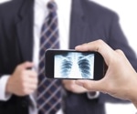 New AI model aims to fix flaws in smartphone-based COVID-19 X-ray diagnosis