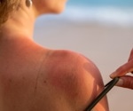The sunscreen paradox: individuals with higher levels of sun exposure use more but not an adequate quantity of sunscreen