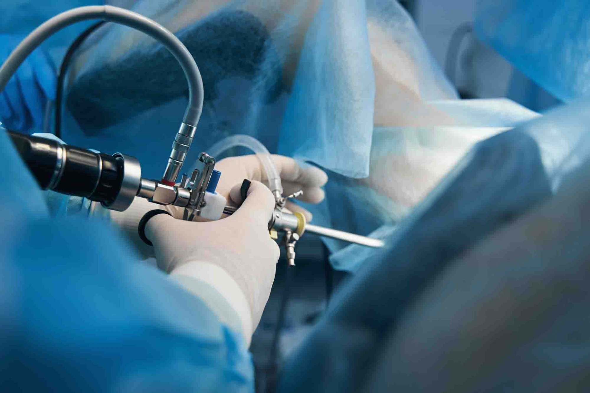 AI-empowered system may accelerate laparoscopic surgery training